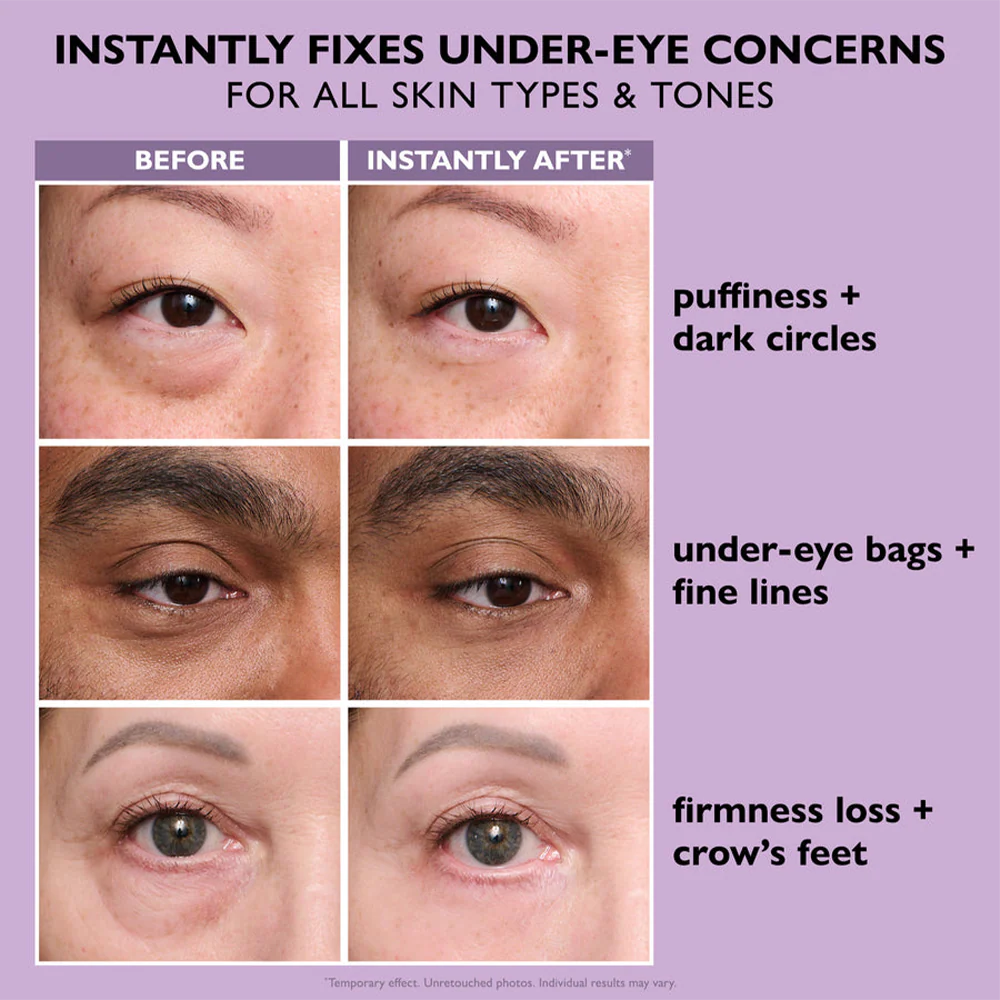 Last 3 hours: 70% off🔥Instant Firming Eye Serum. new formula. ultimate lifting and smoothing effect